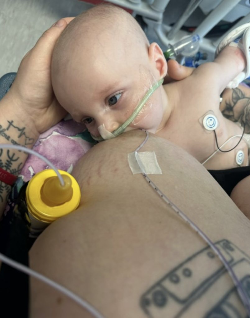 Laryngeal hemangioma